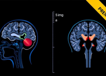 EZH2 Blockade Restores Glioblastoma Sensitivity to Radiotherapy in Preclinical Models