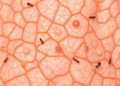 Itch-scratch cycle in lichen simplex chronicus calls for combined drug and non-drug treatment strategies