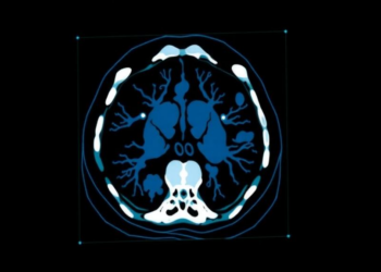 Explainable AI Opens the Black Box of Low-Dose CT Image Reconstruction
