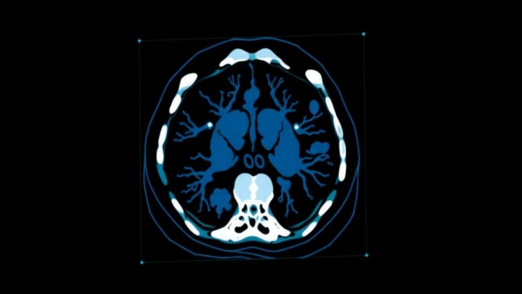 Explainable AI Opens the Black Box of Low-Dose CT Image Reconstruction