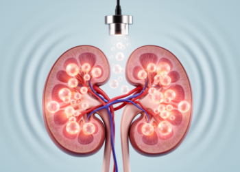 Gentle Ultrasound and Microbubbles Repair Diabetic Kidney Damage in Mice
