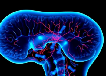 Rare Spinal Cord Damage Emerges as a Hidden Face of CAR T Cell Neurotoxicity