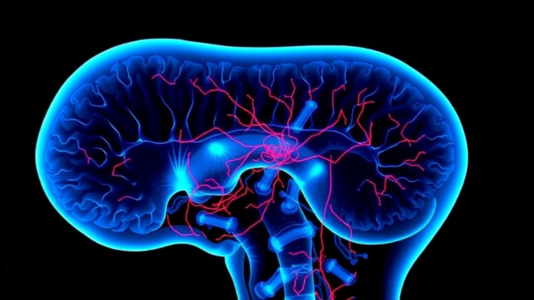 Rare Spinal Cord Damage Emerges as a Hidden Face of CAR T Cell Neurotoxicity