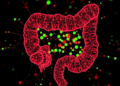 Massive single-cell atlas reveals how diverse gut infections reprogram the intestinal lining