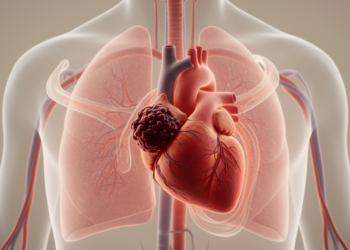 Where the Clot Sits May Shape Right Ventricular Strain After Pulmonary Embolism