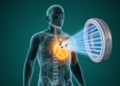 Imaging Modality, Not a Single Blueprint, Defines How Theranostics Work