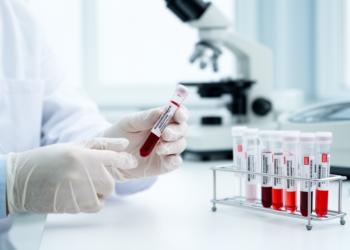 Blood, Stool and Urine Tests Could Track Gut Damage in Children With Celiac Disease