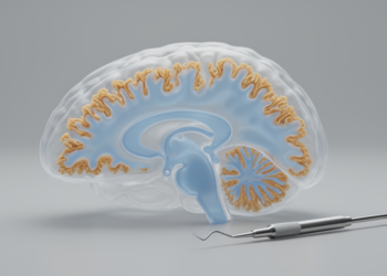 Choroid Plexus Ablation Eases Hydrocephalus Brain Swelling in Mice