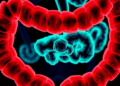 Cell Death Signature in Gut Lining Predicts Inflammatory Bowel Disease Relapse