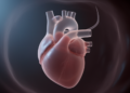 Redundant Foramen Ovale Flap Can Mimic Fetal Coarctation of the Aorta on Prenatal Ultrasound