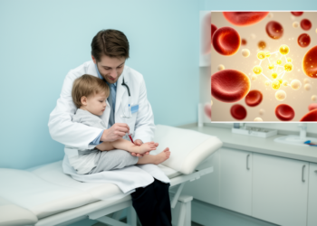 Half of Children with Immune Thrombocytopenia Show Zinc Deficiency, Study Finds