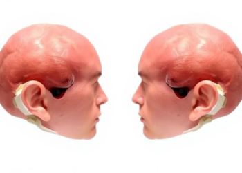 Randomized trial compares autologous and synthetic grafts for cranial duraplasty safety