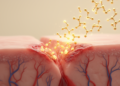 Saikosaponin A Shows Promise for Diabetic Wound Healing in Mouse Study