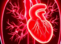 New Feature-Selection Algorithm Predicts Aortic Calcification in Dialysis Patients