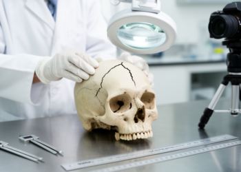 Reading Broken Bone: How Forensic Experts Reconstruct Skull Fractures
