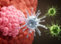 Neutrophils Disable NK Cells to Fuel Breast Cancer Liver Metastasis
