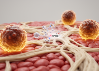 Blocking EP300 Rewires Scar-Associated Macrophages to Fight Acute Liver Failure