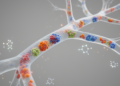 New Framework Sorts Stroke Vasculopathies by Biology, Not Just Imaging
