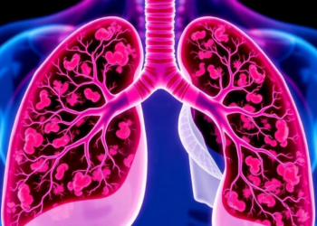 Fungal-Derived Compound DM28 Boosts Immunoradiotherapy in Lung Cancer Model