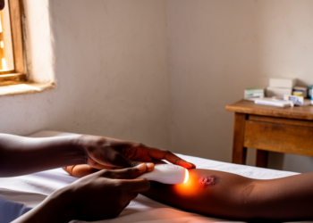 Study Protocol Tests Thermotherapy for Skin Leishmaniasis in Ethiopian Primary Care