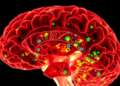 Human Meninges Cell Atlas Upends Century-Old View of Meningioma Origins
