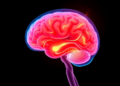 Research report: Fulminant pancreatic encephalopathy with brain edema and herniation in severe hypertriglyceridemia-induced pancreatitis: a case report