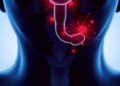 Macrophage-linked biomarkers flagged for esophageal cancer chemoradiotherapy response in computational study