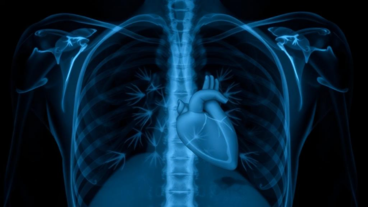 AI Reads Chest X-rays to Spot Early Heart Dysfunction in Obesity and Diabetes