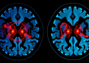 Dual-Key Chaotic Encryption Targets Critical Regions of Medical CT Images