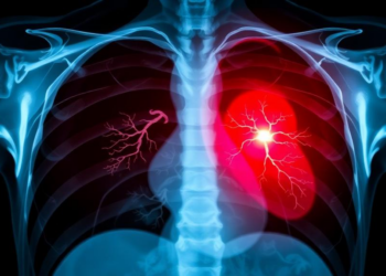 Deep Learning Reads Chest X-rays to Gauge Pulmonary Artery Growth in Children with Heart Defects