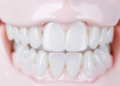 New Open-Access Journal Launches to scrutinize Digital and Aligner Orthodontics