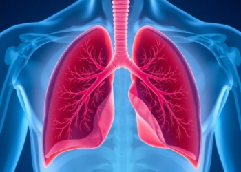 Simple Positioning Change After Lung Biopsy Linked to Fewer Collapsed Lungs in Retrospective Study