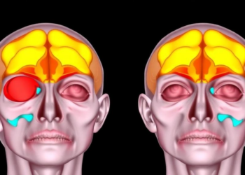 Superior Transposition of Horizontal Rectus Muscles Corrected Hypotropia in Two Traumatic Third Nerve Palsy Cases