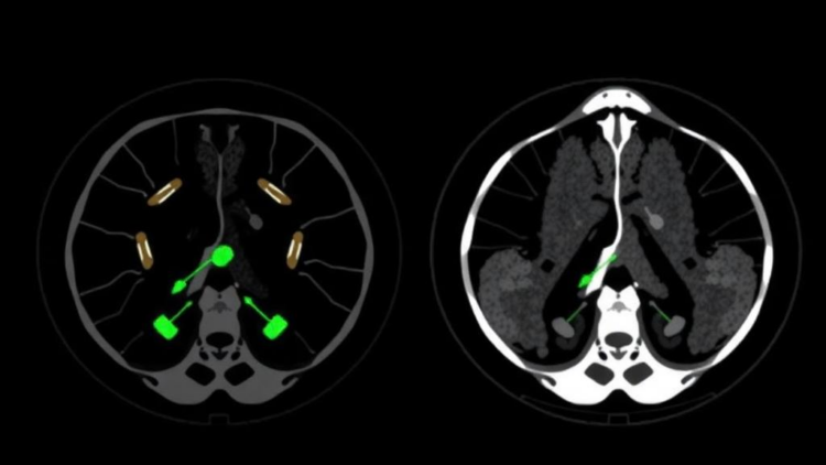 Dual-Tracer PET/CT Imaging Linked to Tumor Aggressiveness in Liver Cancer