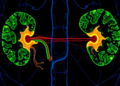Four-Gene Signature Predicts Prostate Cancer Recurrence and Flags SPAG5 as Drug Target