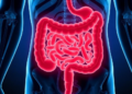 Gut Microbe Networks Rewire Themselves in Ulcerative Colitis, Study Finds