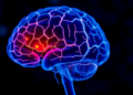 Tear Fluid α-Synuclein Shows Promise as Noninvasive Biomarker for Parkinson's Disease