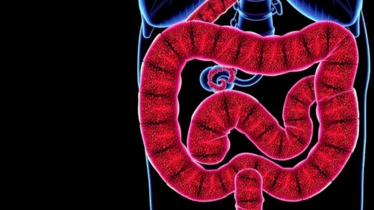 Macrophage TRPV1 Loss Worsens Diet-Driven Colitis and Gut Fibrosis in Mice