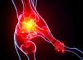 TLR4 Blocker TAK-242 Calms Inflamed Stem Cells Without Blocking Bone Formation