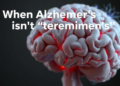When Alzheimer's Isn't Alzheimer's: Prion Disease Hides in Rapid Dementia Cases