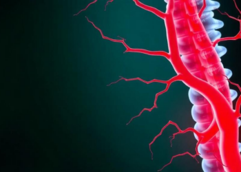 Blood fat indices linked to early artery damage in spondyloarthritis patients
