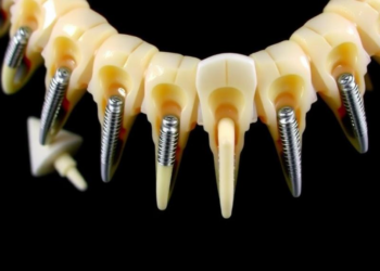PCL Coating Keeps PLGA Suture Anchors Strong as They Degrade, Study Finds