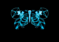 CNN or Transformer? AI Duel Reveals Best Way to Read X-ray Patterns
