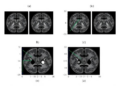 Ensemble AI Reads Brain MRI With Adaptive Attention and Statistical Rigor