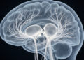 Brain Wiring Disrupted in Idiopathic Normal Pressure Hydrocephalus, Imaging Study Finds