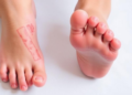 Foot Ulcers and Failing Memory: Review Maps the Cognitive Toll of Diabetes