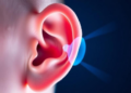Radiation Damage to a Tiny Ear Muscle May Drive Hearing Loss After Cancer Therapy