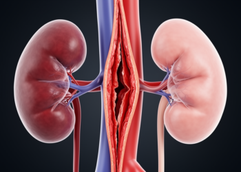 Reduced False Lumen Flow Near the Renal Arteries Emerges Early After Aortic Dissection Repair in Kidneys That Later Atrophy