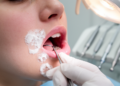 Oral clues to a rare keratin disorder: review maps mouth signs to gene mutations