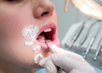 Oral clues to a rare keratin disorder: review maps mouth signs to gene mutations
